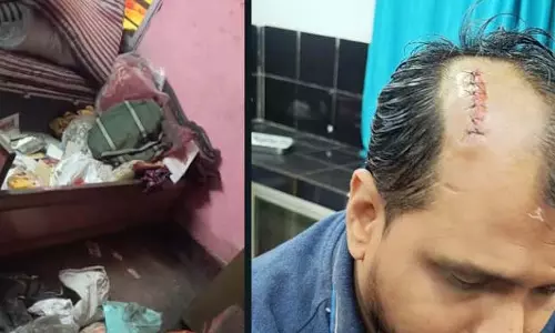 चोरों ने किया हमला, दो ग्रामीण हुए लहूलुहान