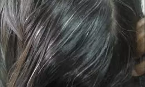 Ghaziabad: जांच में पता चला की पोषक तत्वों की कमी से कम उम्र में ही सफेद हो रहे बाल Ghaziabad: जांच में पता चला की पोषक तत्वों की कमी से कम उम्र में ही सफेद हो रहे बाल