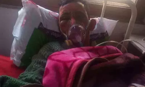 Chamba के जंगल में आग लगने से 3 लोग झुलसे Chamba के जंगल में आग लगने से 3 लोग झुलसे
