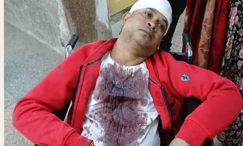 West Bengal: अभियोजक के मुंह में मेयर परिषद का नाम, विवाद West Bengal: अभियोजक के मुंह में मेयर परिषद का नाम, विवाद