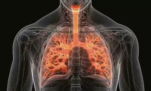 शहर में दो वर्षों में TB से 278 मौतें दर्ज