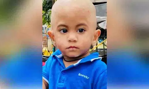 Kamineni के डॉक्टरों ने असामान्य मस्तिष्क वाले 3 महीने के बच्चे को नया जीवन दिया Kamineni के डॉक्टरों ने असामान्य मस्तिष्क वाले 3 महीने के बच्चे को नया जीवन दिया