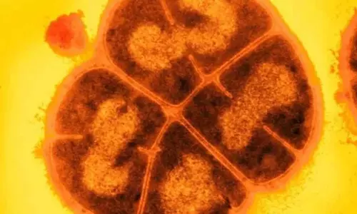 Extremophile सूक्ष्म जीव जिसे कॉनन द बैक्टीरिया कहा जाता है, नए एंटीऑक्सीडेंट को करता है प्रेरित