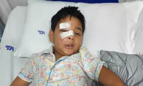 Mira Road पर आवारा कुत्तों के हमले में 8 वर्षीय बच्चा गंभीर रूप से घायल Mira Road पर आवारा कुत्तों के हमले में 8 वर्षीय बच्चा गंभीर रूप से घायल