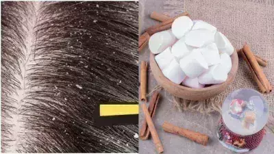 Lifestyle: डैंड्रफ की समस्या से पाना है छुटकारा, कपूर के साथ इन चीजों का इस्तेमाल करे Lifestyle: डैंड्रफ की समस्या से पाना है छुटकारा, कपूर के साथ इन चीजों का इस्तेमाल करे