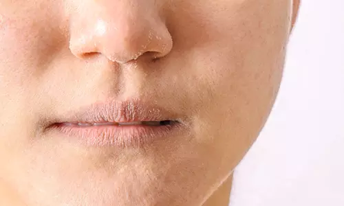 Lifestyle: सर्दियों में स्किन हो रही ड्राई, तो यह होम मेड फेस पैक लगाए