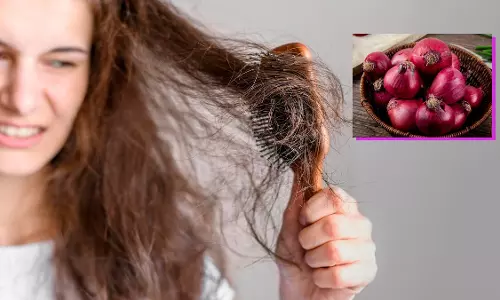 Lifestyle: तेजी से झड़ते बालों को रोकने के लिए ट्राई करें ये प्याज और लौंग वाला नुस्खा Lifestyle: तेजी से झड़ते बालों को रोकने के लिए ट्राई करें ये प्याज और लौंग वाला नुस्खा