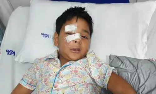Mumbai: आवारा कुत्ते ने 8 साल के लड़के पर किया हमला, गंभीर रूप से घायल Mumbai: आवारा कुत्ते ने 8 साल के लड़के पर किया हमला, गंभीर रूप से घायल