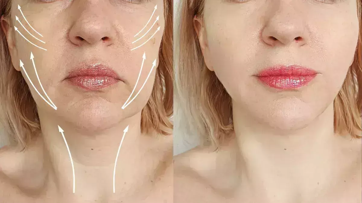 Lifestyle: चेहरे पर पाना चाहते हैं झुर्रियों से छुटकारा, फॉलो करें यह टिप्स