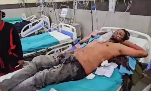 ऑटो से हटने कहा तो बदमाश ने मारा चाकू, ड्राइवर गंभीर रूप से घायल