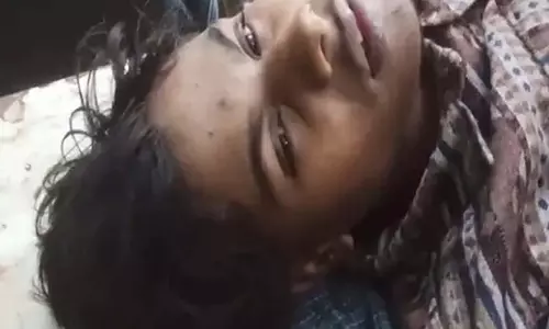 भिलाई में 2 गुटों में झड़प, कटर हमले से किशोर घायल