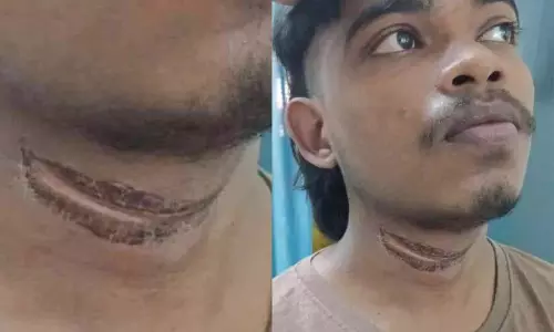 Kerala: सड़क पर टूटा केबल एक बाइक सवार की गर्दन में फंस गया Kerala: सड़क पर टूटा केबल एक बाइक सवार की गर्दन में फंस गया