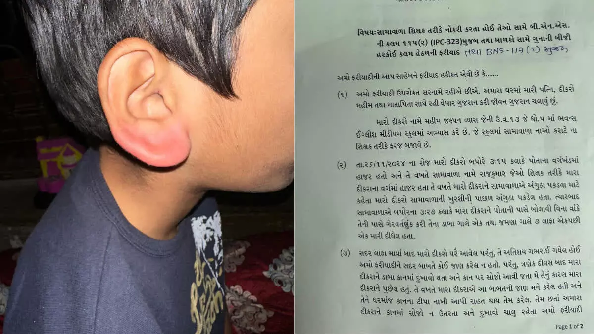 डाकोर में Teacher ने एक छात्र को थप्पड़ मारा, माता-पिता ने पुलिस में दर्ज कराई शिकायत