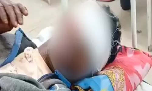 Balangir में अज्ञात बदमाशों ने शख्स को नशीला पदार्थ खिलाकर फोड़ दीं उसकी आंखें Balangir में अज्ञात बदमाशों ने शख्स को नशीला पदार्थ खिलाकर फोड़ दीं उसकी आंखें