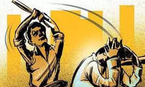 Up News: मुर्गे को लेकर बवाल,  दुकानदार पर धारदार हथियार से हमला