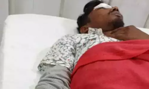 अपहरण में नाकाम बदमाशों ने बीजेपी नेता के बेटे को बेरहमी से पीटा