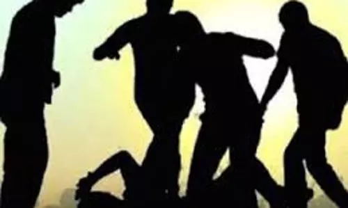 Bahraich: माचिस देने से मना करने पर बदमाशों ने एक परिवार पर किया हमला