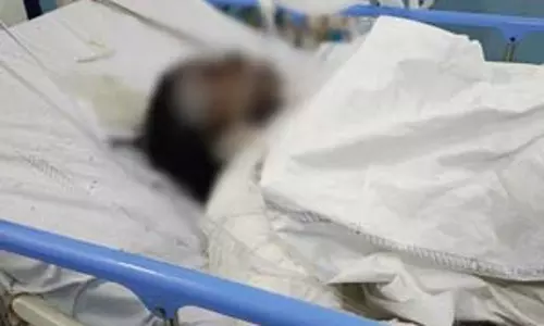 हजारीबाग के एसडीओ पर पत्नी को जलाने का आरोप, भाई ने पुलिस से मांगा इंसाफ