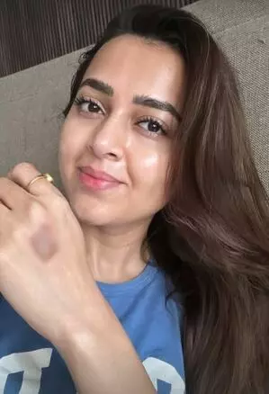 Tejasswi Prakash को सेट पर लगी चोट