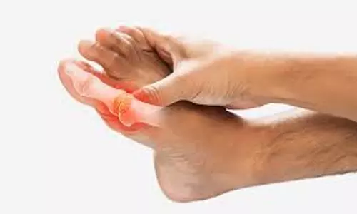 Health:  बिना दवा और घरेलू नुस्खों के ठीक हो सकता है यूरिक एसिड, बस आपको हर दिन करना होगा ये एक काम