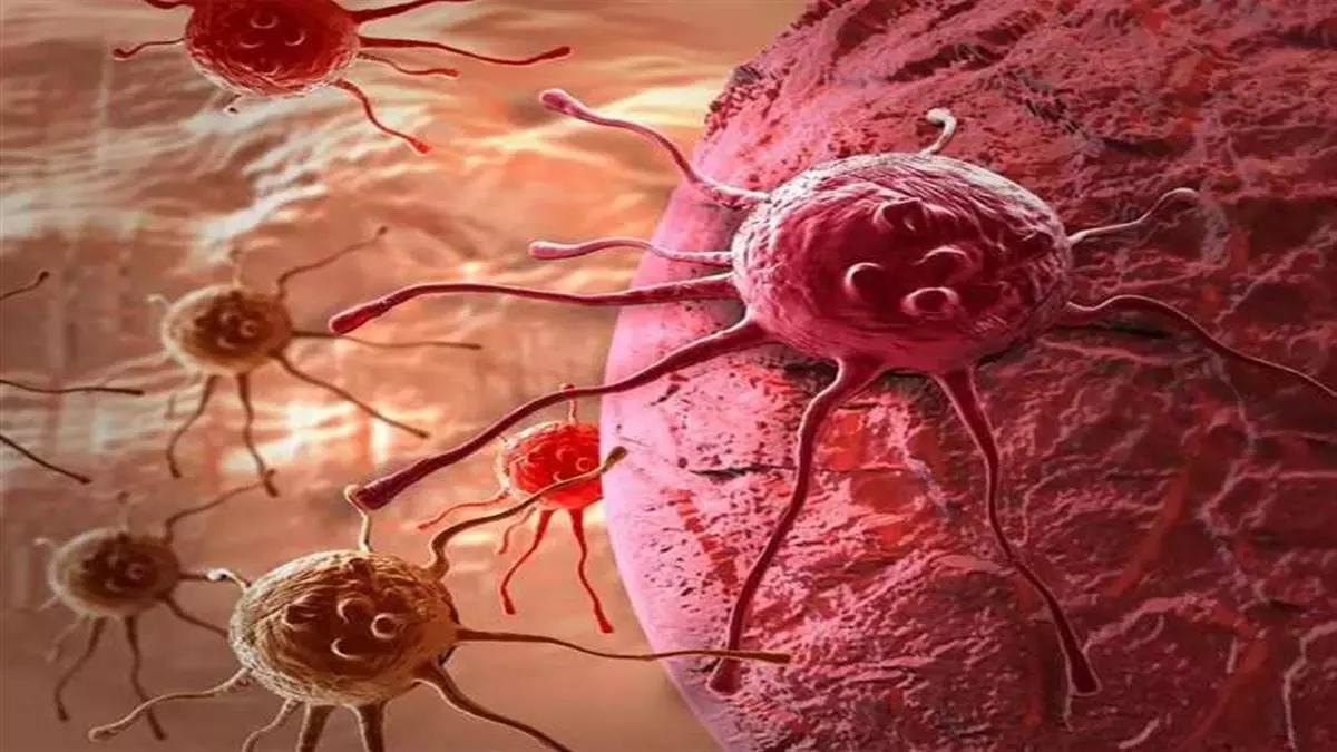 Cancer: नए साल पर लाइफस्टाइल को लेकर संकल्प कैंसर जोखिम को करेगा कम