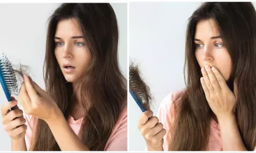 Lifestyle: झड़ते बालों से पाना है छुटकारा, तो अपनायें यह तरीका Lifestyle: झड़ते बालों से पाना है छुटकारा, तो अपनायें यह तरीका