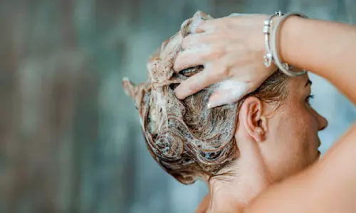 Hair Care: सर्दियों में बालों की देखभाल: तैलीय सिर और रूसी मुक्त बालों के लिए प्राकृतिक समाधान Hair Care: सर्दियों में बालों की देखभाल: तैलीय सिर और रूसी मुक्त बालों के लिए प्राकृतिक समाधान