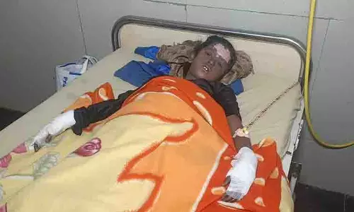 Chandigarh: अलाव में विस्फोट के बाद तीन बच्चे झुलस गए