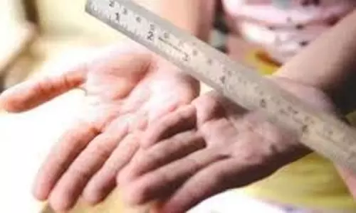 UP News:  बदमाशों ने चार साल की मासूम को पीटा और उसके दांत तोड़े