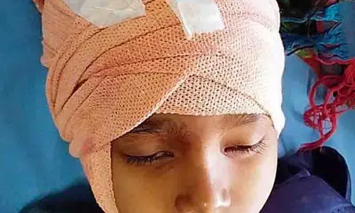 Jalandhar: घर के बाहर खेल रहे बच्चे को कुत्तों ने किया घायल