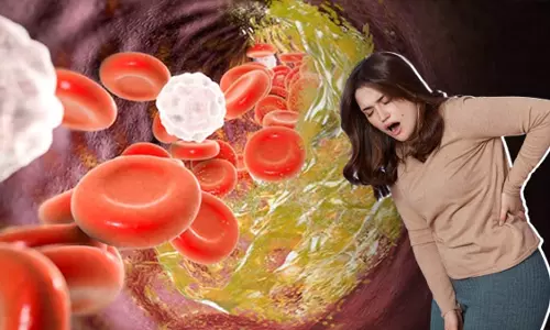 Lifestyle: बढ़ते Cholesterol पर लगाम लगाने के लिए घर पर ये काम शुरू करें