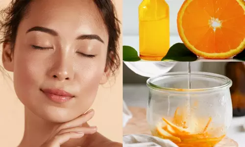 Lifestyle: ठण्ड में चाहते हैं खिली त्वचा, तो संतरे के छिलके से बनाएं विटामिन सी टोनर