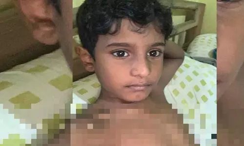Kerala :  कन्नूर में आवारा कुत्ते को देखकर 9 वर्षीय बच्चे को लगा कि वह कुएं में गिर गया