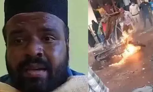 Bullet Bike विस्फोट में जीवित बचे व्यक्ति ने सर्जरी के लिए धन की मांग की