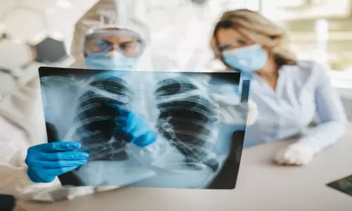 Lung Transplant के बाद महिलाओं के जीवित रहने की संभावना पुरुषों की से अधिक- अध्ययन Lung Transplant के बाद महिलाओं के जीवित रहने की संभावना पुरुषों की से अधिक- अध्ययन
