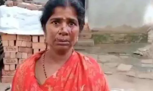 Sircilla में सियार ने महिला पर हमला किया, ग्रामीणों ने उसे मार डाला