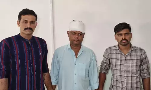 Surat में फ्रेंच फ्राइज़ के ऑर्डर पर जानलेवा शरारत, वेटर ने सहकर्मी पर किया जानलेवा हमला