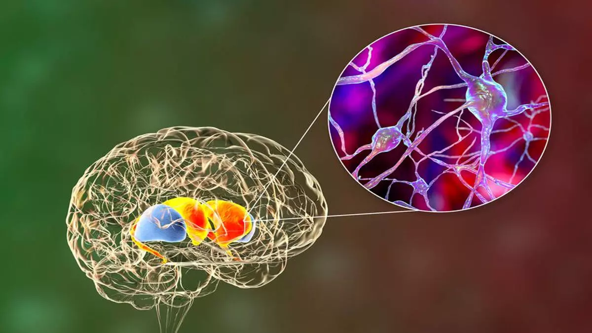 New Stem Cell Therapy स्ट्रोक के बाद मस्तिष्क की रिकवरी के लिए आशा