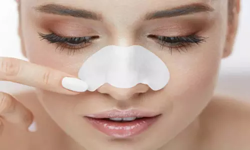 Blackheads Remove:ब्लैकहेड्स हटाने के लिए हाइड्रोजन पेरोक्साइड का उपयोग कैसे करें