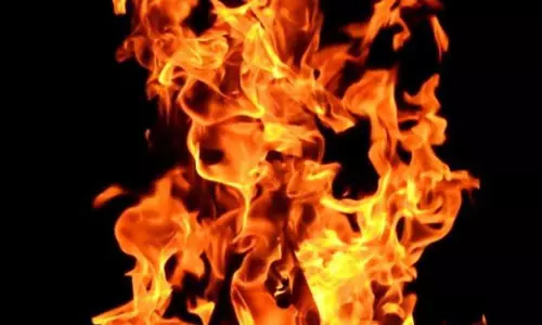 Odisha: बालासोर में मिठाई की दुकान में आग लगने से तीन लोग झुलसे Odisha: बालासोर में मिठाई की दुकान में आग लगने से तीन लोग झुलसे