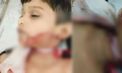 HC ने रायपुर में चाइनीज मांझे से मौत मामले में CS को जारी किया नोटिस