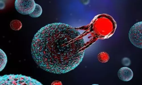 इम्यूनील ने भारत में नॉन-हॉजकिन लिंफोमा के लिए किफायती CAR T-cell थेरेपी शुरू की इम्यूनील ने भारत में नॉन-हॉजकिन लिंफोमा के लिए किफायती CAR T-cell थेरेपी शुरू की