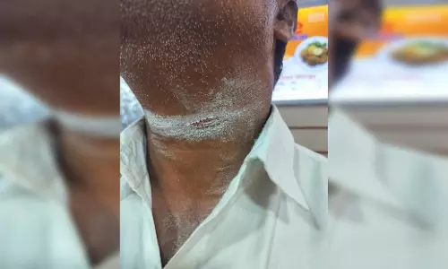 रायपुर में मांझे से एक और की गर्दन कटी, बची जान रायपुर में मांझे से एक और की गर्दन कटी, बची जान