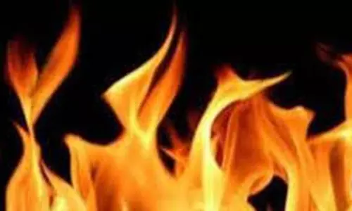 Kanpur:  जच्चा बच्चा अस्पताल में चैनल के अंदर लगी आग, मचा हडकंप