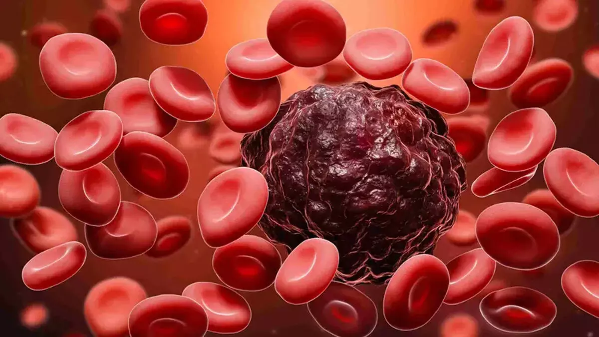 Blood Cancer से लड़ने के लिए जीवित दवा कार्तेमी को मंजूरी, जानिए कैसे काम करती है यह दवा