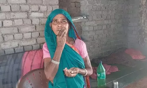 डॉक्टर भी नहीं कर पाए ठीक, लाल पत्थर से महिला को दांत दर्द से मिल रही राहत