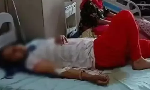 पति ने दांतों से काटा पत्नी का होंठ, 16 टांके लगे