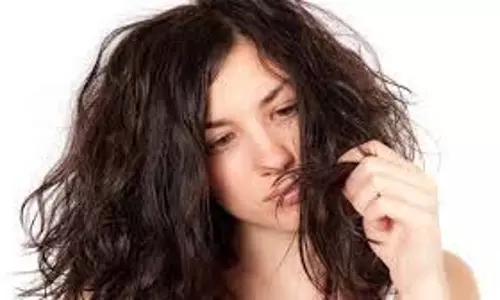 Hair Care: सर्दियों में अगर आपके बाल भी रूखे हो गए हैं तो अपनाएं ये टिप्स Hair Care: सर्दियों में अगर आपके बाल भी रूखे हो गए हैं तो अपनाएं ये टिप्स
