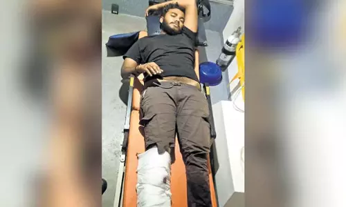 Karnataka: कर्नाटक के होन्नावर गोहत्या मामले में पुलिस ने आरोपी को गोली मारी Karnataka: कर्नाटक के होन्नावर गोहत्या मामले में पुलिस ने आरोपी को गोली मारी
