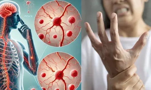 Mumbai: गुइलेन-बैरे सिंड्रोम से पहली संदिग्ध मौत हुई: स्वास्थ्य विभाग Mumbai: गुइलेन-बैरे सिंड्रोम से पहली संदिग्ध मौत हुई: स्वास्थ्य विभाग